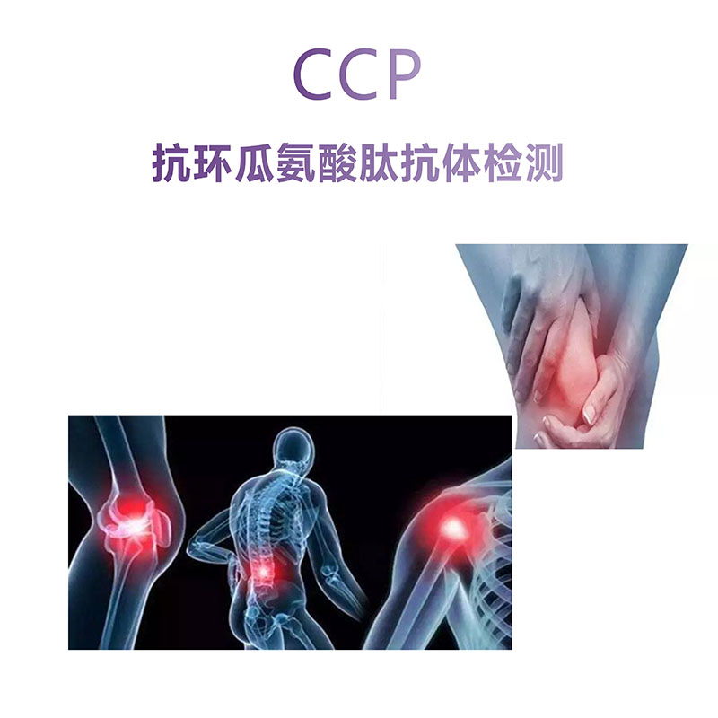 CCP抗環(huán)瓜氨酸肽抗體檢測(cè)