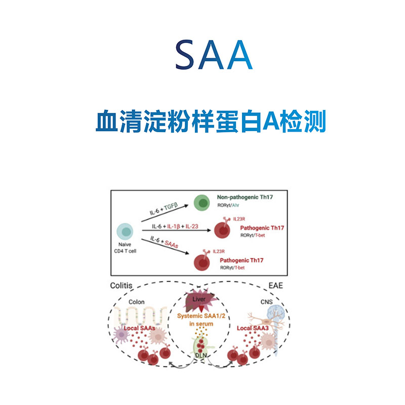 SAA 血清淀粉樣蛋白A檢測(cè)