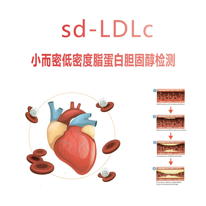 sd-LDLc 小而密低密度脂蛋白膽固醇檢測(cè)