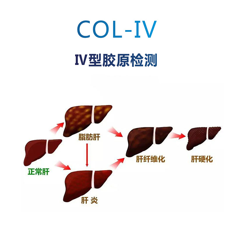 COL-IV IV型膠原檢測(cè)