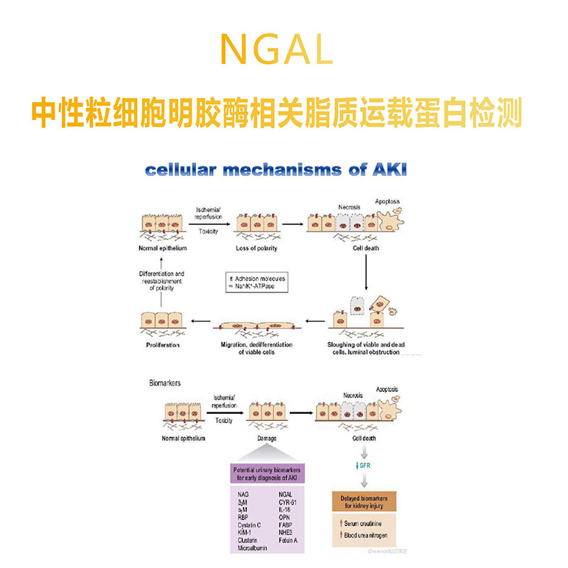 NGAL-中性粒細(xì)胞明膠酶相關(guān)脂質(zhì)運(yùn)載蛋白檢測(cè)